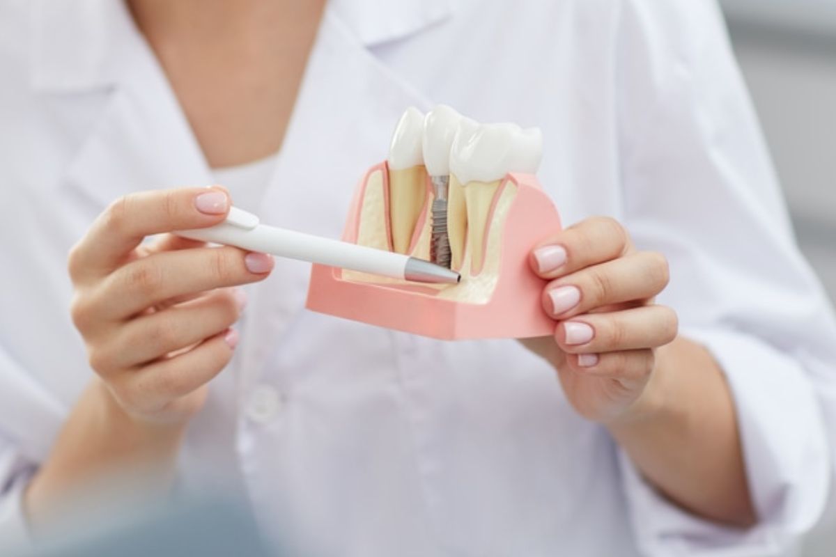 Common Mistakes To Avoid After Dental Implant Surgery