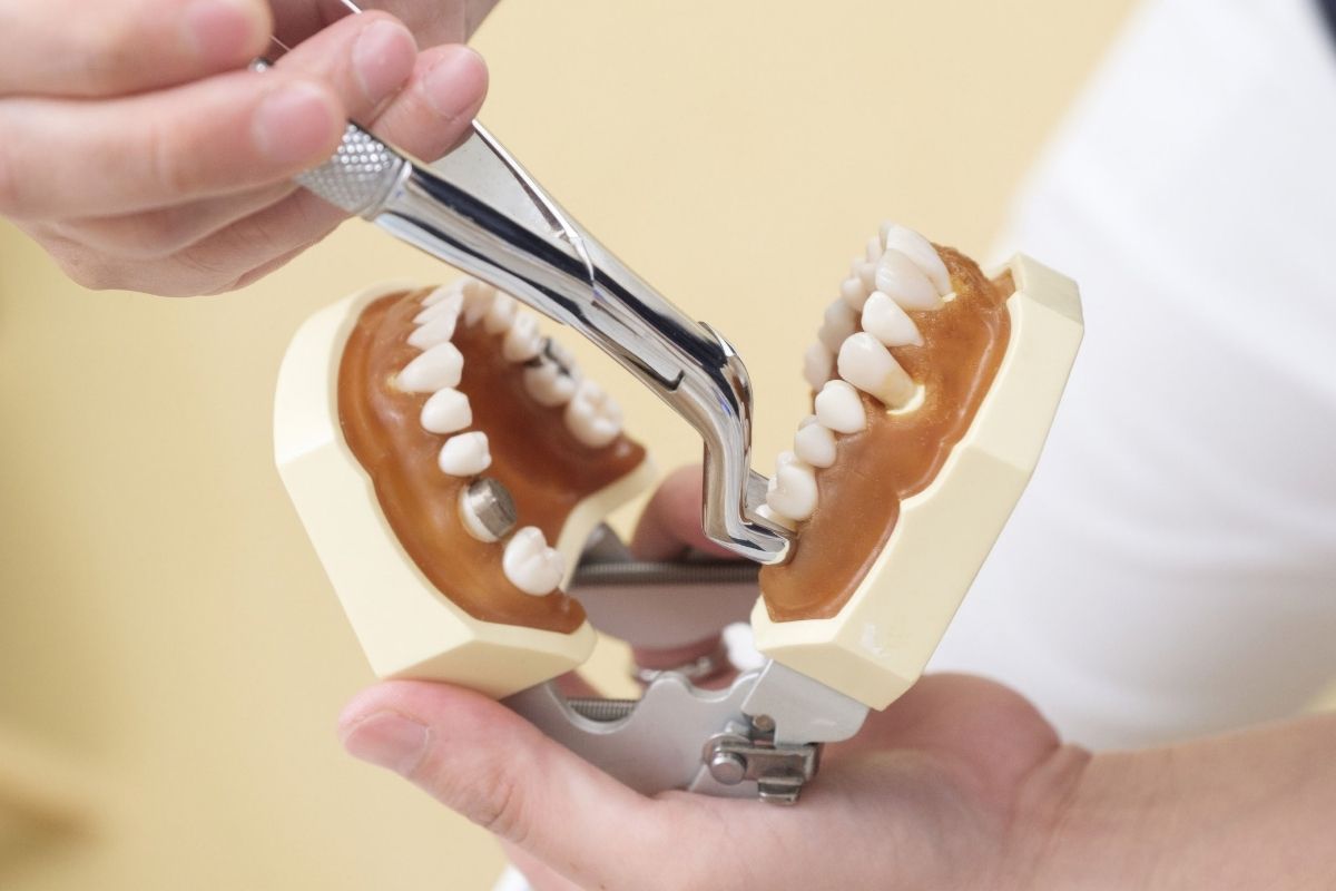 What are the Common Reasons Periodontists Recommend Tooth Extraction?
