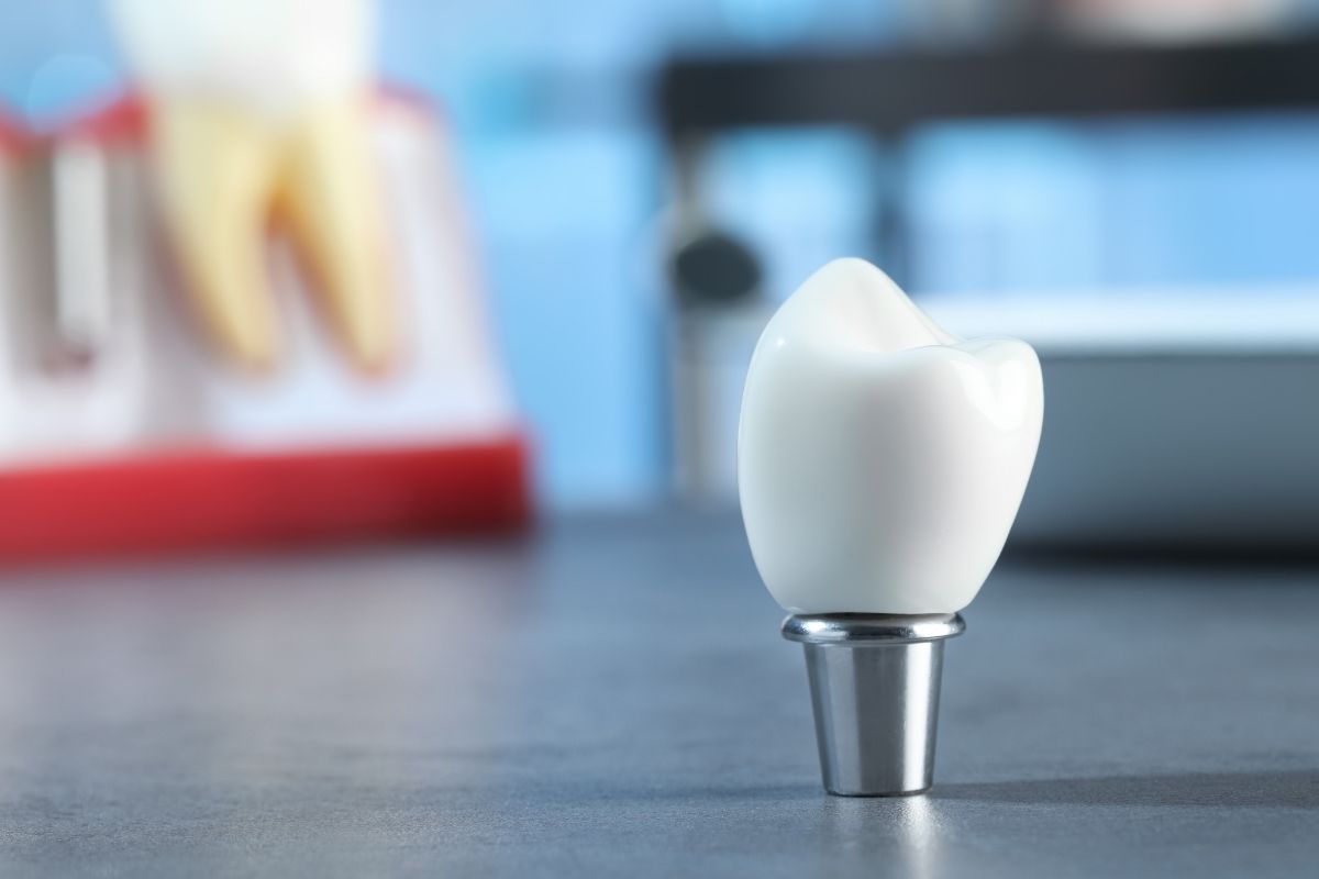What Are The Risks And Complications Of Dental Implants?