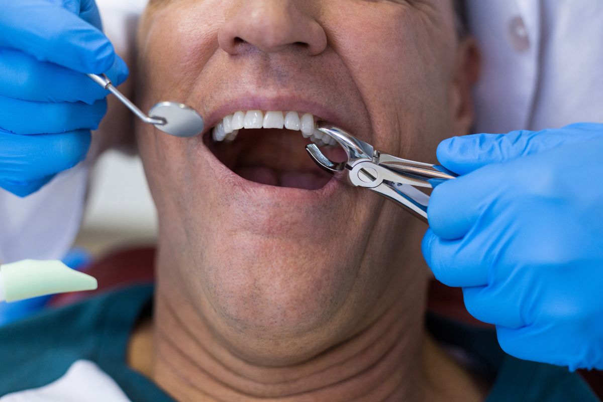 How to Manage Swelling After Tooth Extraction?