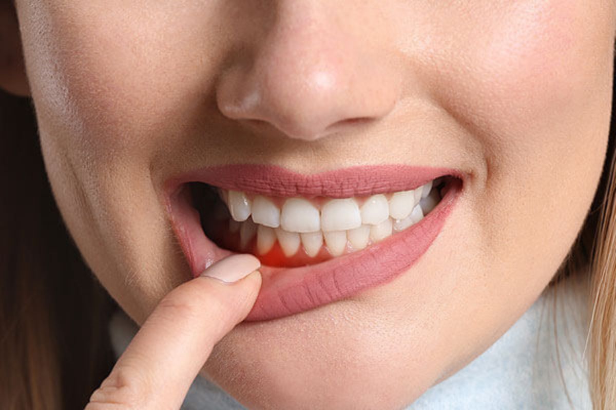 How Often to Follow Up After Periodontal Treatment?